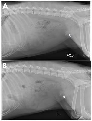 Case report: Transmural migration of a gossypiboma with secondary cystolithiasis and urethral obstruction